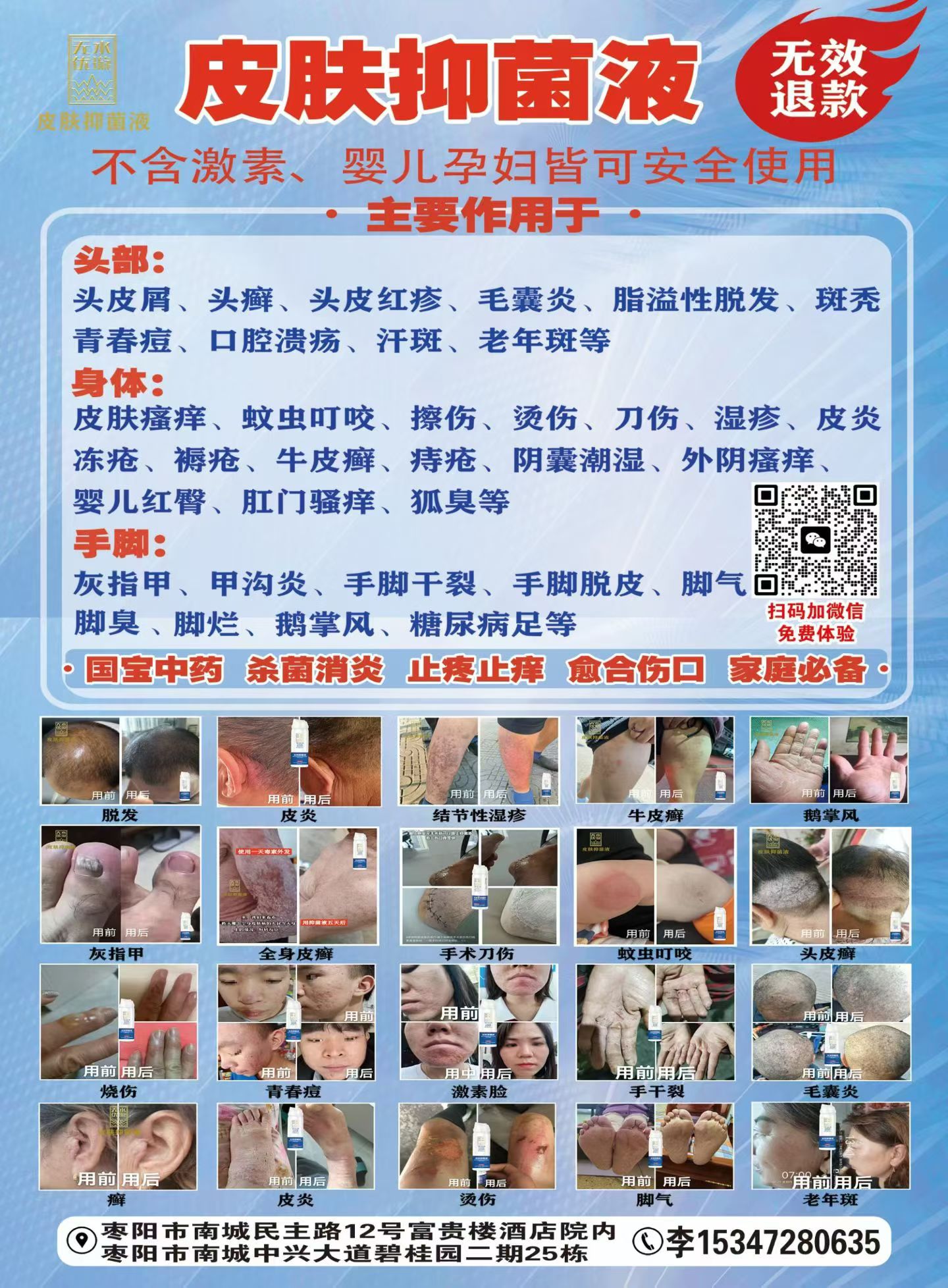 李小刚ˉ专注各类皮肤问题